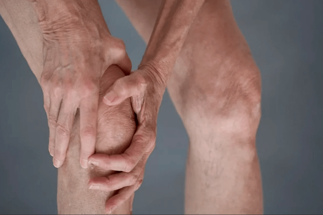 bolečine v sklepih so lahko vzrok za artrozo ali artritis