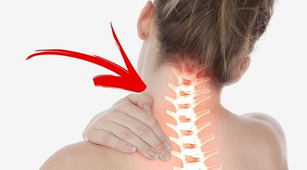 lezija hrbtenice z osteohondrozo materničnega vratu