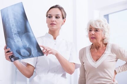 Rentgenski pregled je informativen način za diagnosticiranje osteohondroze hrbtenice