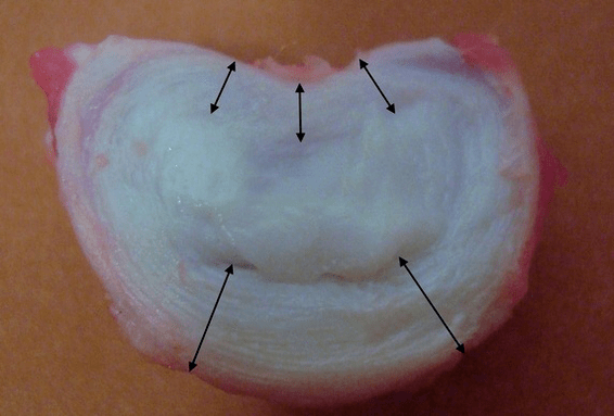 kako izgleda medvretenčna ploščica