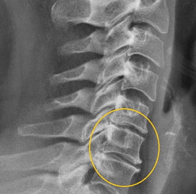 Diagnostična slika